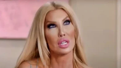 Nikki Exotika’s SHOCKING Face Before Cosmetic Surgery