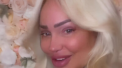 Stacey Silva shows off the results of her recent facelift after full recovery Stacey Silva shows off the results of her recent facelift after full recovery