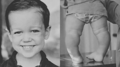 LPBW: It’s So Heartbreaking To See Jackson’s Health Condition, Fans Are Sending Prayers!