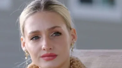 Moriah Plath Has Only One Remaining Eyelashes As Alopecia Worsens!