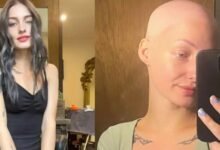 Welcome to Plathville: Moriah Plath Shares Candid Update On Alopecia Battle!