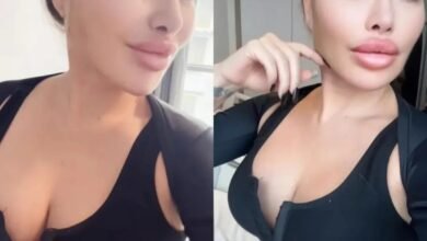 Stacey Silva looks amazing after removing her implants Stacey Silva looks amazing after removing her implants