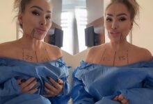 Stacey Silva Is Finally Getting A Br£ast Reduction Surgery — But Fans Think It’s Too Late! Stacey Silva Is Finally Getting A Br£ast Reduction Surgery — But Fans Think It’s Too Late!