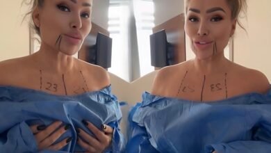 Stacey Silva Is Finally Getting A Br£ast Reduction Surgery — But Fans Think It’s Too Late!