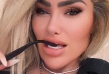 Darcey Silva Finally Getting Fillers Removed From Her Face! Darcey Silva Finally Getting Fillers Removed From Her Face!