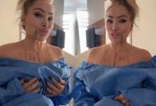 90 Day Fiance: Stacey Silva Is Finally Getting A Br£ast Reduction Surgery — But Fans Think It’s Too Late!