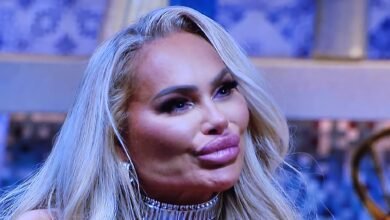 Darcey Silva’s SHOCKING Face After Removing Fillers From Her Face!