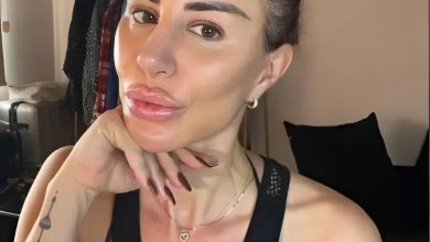 90 Day Fiance: Shekinah’s Face Left Bruised After Intense Cosmetic Procedures [See Clip]