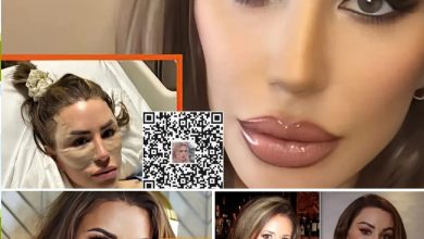 Shekinah Garner ruins her looks with another Plastic surgery