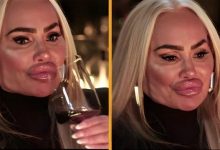 UNBELIEVABLE Darcey Silva’s SHOCKING Face After Removing Fillers From Her Face!
