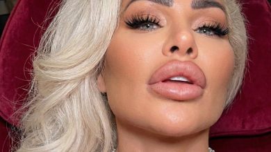 Fans Shocked by Darcey Silva’s Post-Surgery Video — Be Prepared to Be Surprised