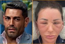 Shekinah Garner Finally Has Her Dream Face in 2026 After Undergoing Multiple Successful Plastic Surgeries