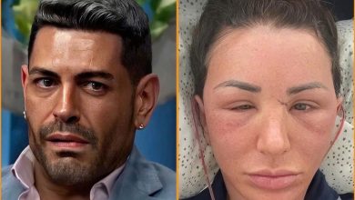 Shekinah Garner Finally Has Her Dream Face in 2026 After Undergoing Multiple Successful Plastic Surgeries